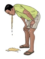 Symptoms-vomiting.webp