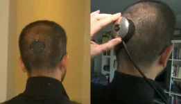 camera_in_back_of_head.webp