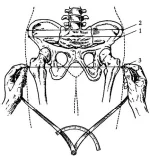ris 24.webp